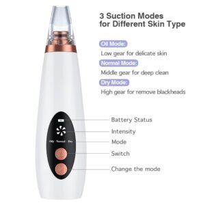 Blackhead Remover
